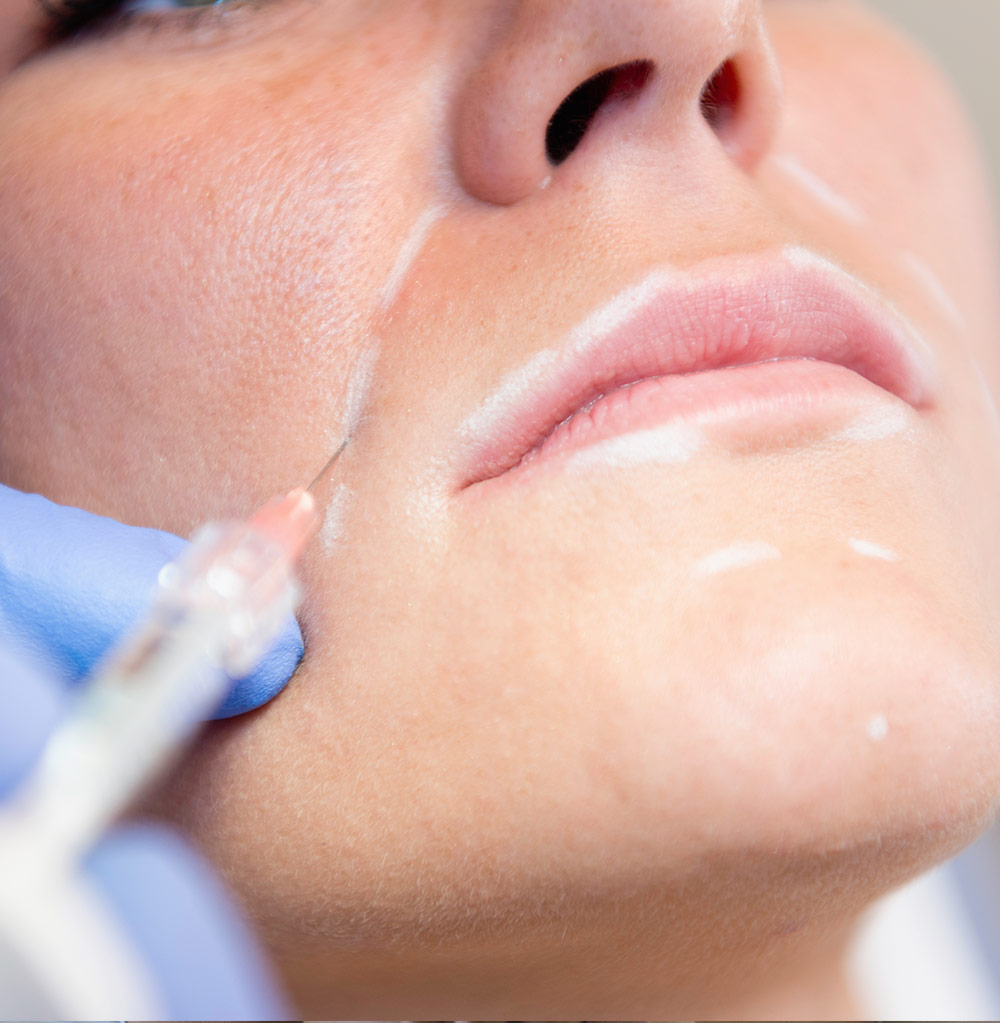 Banner_servicios_acido-hialurónico